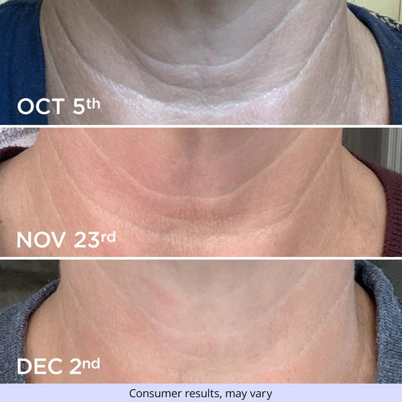 Necktight™ firming neck cream